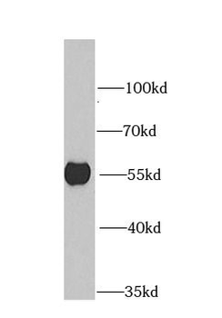 DARS1 Rabbit Polyclonal Antibody