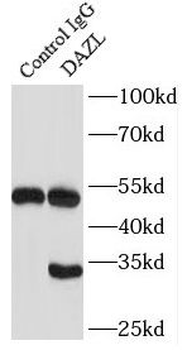 DAZL Rabbit Polyclonal Antibody