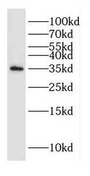DAZL Rabbit Polyclonal Antibody