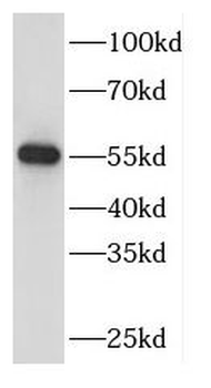 DBNL Rabbit Polyclonal Antibody