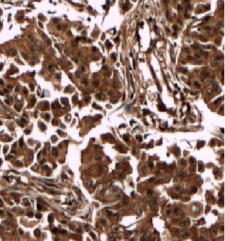 DBNL Rabbit Polyclonal Antibody