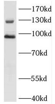 DCBLD2 Rabbit Polyclonal Antibody