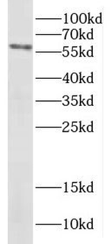 DCLRE1C Rabbit Polyclonal Antibody
