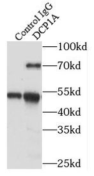 DCP1A Rabbit Polyclonal Antibody