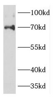 DCP1A Rabbit Polyclonal Antibody