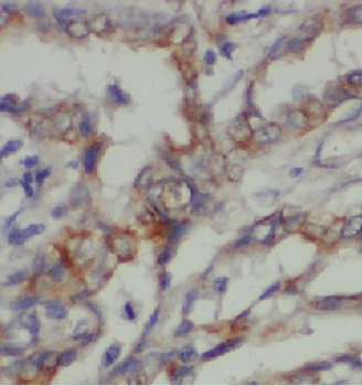 DCP1A Rabbit Polyclonal Antibody