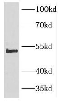 TNFRSF10D Rabbit Polyclonal Antibody