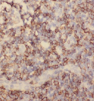 TNFRSF10D Rabbit Polyclonal Antibody