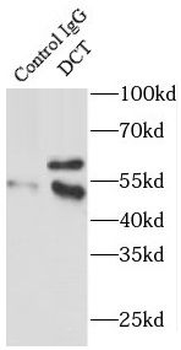DCT Rabbit Polyclonal Antibody