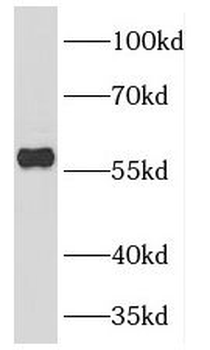 DCT Rabbit Polyclonal Antibody
