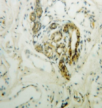 DCT Rabbit Polyclonal Antibody