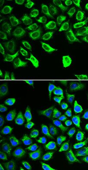 DDAH2 Rabbit Polyclonal Antibody