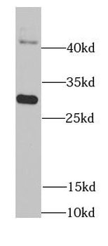 DDAH2 Rabbit Polyclonal Antibody