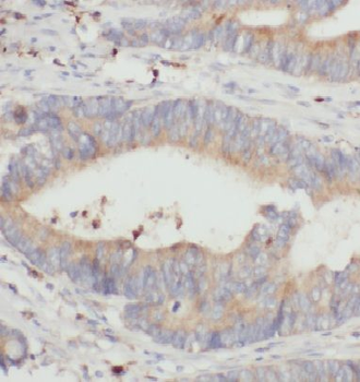 DDAH2 Rabbit Polyclonal Antibody