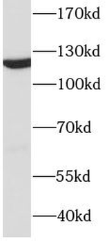 DDB1 Mouse Monoclonal Antibody