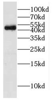 DDOST Rabbit Polyclonal Antibody