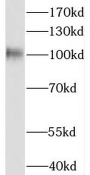 DDX10 Rabbit Polyclonal Antibody