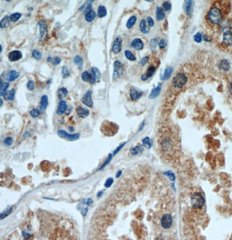 DDX10 Rabbit Polyclonal Antibody