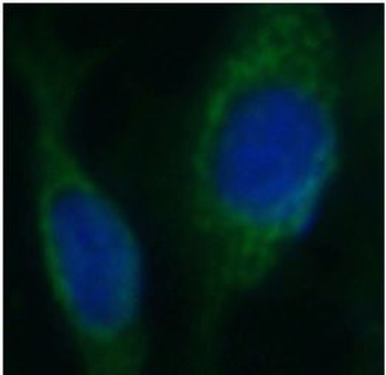 DCN Rabbit Polyclonal Antibody
