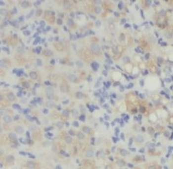 DCN Rabbit Polyclonal Antibody