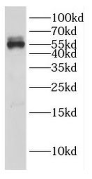 DEPTOR Rabbit Polyclonal Antibody