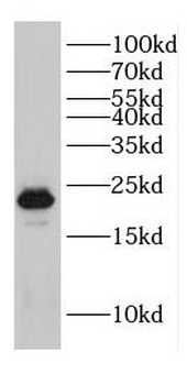 DPT Rabbit Polyclonal Antibody