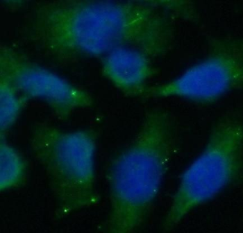 DHFR Rabbit Polyclonal Antibody