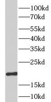 DHFR Rabbit Polyclonal Antibody
