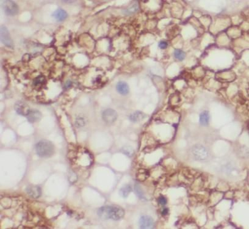 DHFR Rabbit Polyclonal Antibody