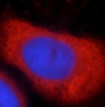DICER1 Rabbit Polyclonal Antibody