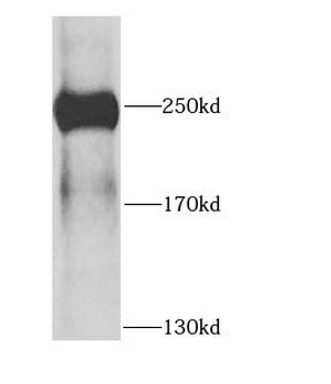 DICER1 Rabbit Polyclonal Antibody