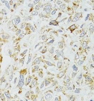 DICER1 Rabbit Polyclonal Antibody