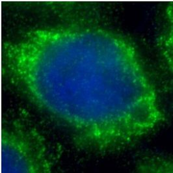 DKK1 Rabbit Polyclonal Antibody
