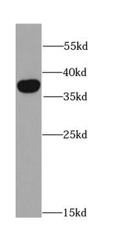 DKK3 Rabbit Polyclonal Antibody