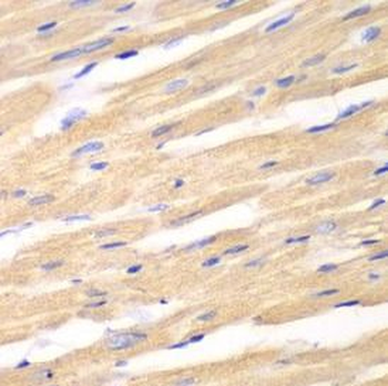 DKK3 Rabbit Polyclonal Antibody