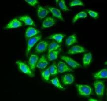 DLAT Rabbit Polyclonal Antibody