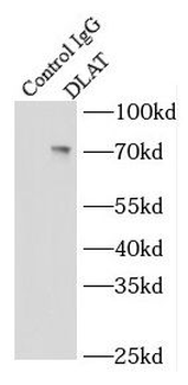 DLAT Rabbit Polyclonal Antibody