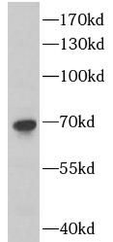 DLAT Rabbit Polyclonal Antibody