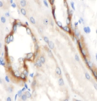 DLAT Rabbit Polyclonal Antibody