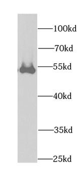 DLD Rabbit Polyclonal Antibody