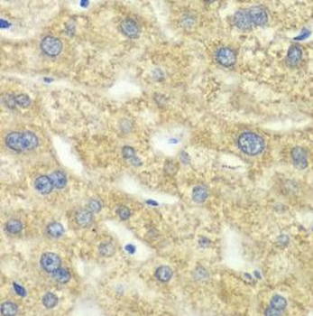 DLD Rabbit Polyclonal Antibody