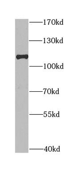 DLG1 Rabbit Polyclonal Antibody