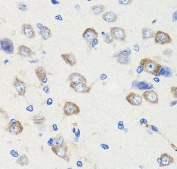 DLG1 Rabbit Polyclonal Antibody