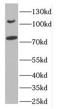 DLG5 Rabbit Polyclonal Antibody
