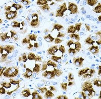 DLK1 Rabbit Polyclonal Antibody