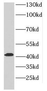 DLK2 Rabbit Polyclonal Antibody