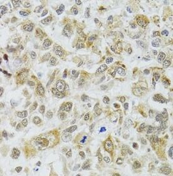 DMAP1 Rabbit Polyclonal Antibody