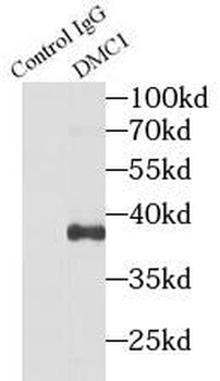 DMC1 Rabbit Polyclonal Antibody
