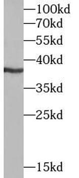 DMC1 Rabbit Polyclonal Antibody