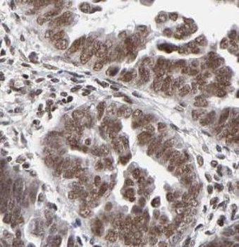 DMC1 Rabbit Polyclonal Antibody